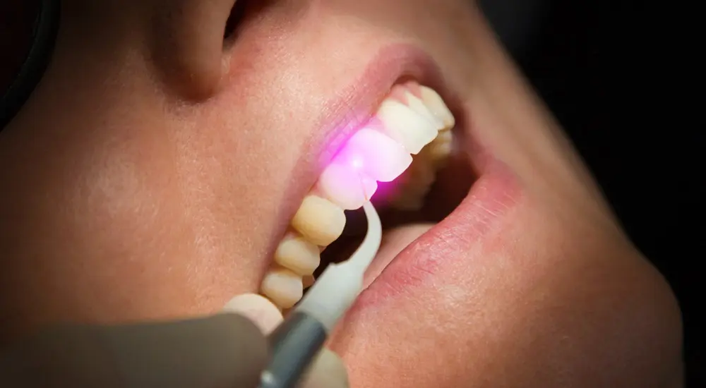 Soft-Tissue-Laser-Services-2 Soft-Tissue-Laser-Services-2