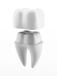 porcelain crowns Albany