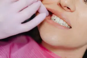 Photo by www.kaboompics.com: https://www.pexels.com/photo/a-person-wearing-latex-gloves-checking-a-woman-s-teeth-6627526/ – woman at the dentist, mouth exam