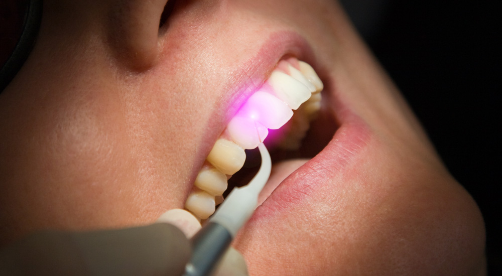 Soft-Tissue-Laser-Services-2 Soft-Tissue-Laser-Services-2