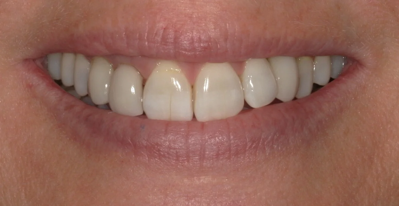 DeSanti Smile Gallery 17 Before