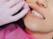 Photo by www.kaboompics.com: https://www.pexels.com/photo/a-person-wearing-latex-gloves-checking-a-woman-s-teeth-6627526/ – woman at the dentist, mouth exam